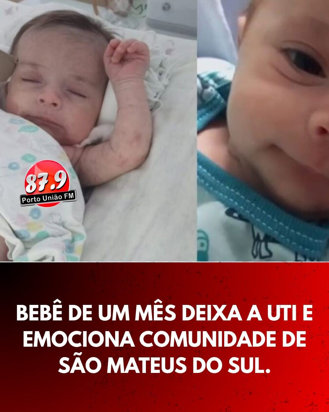 Após dias de apreensão, bebê Ryan deixa a UTI e segue recuperação em quarto hospitalar