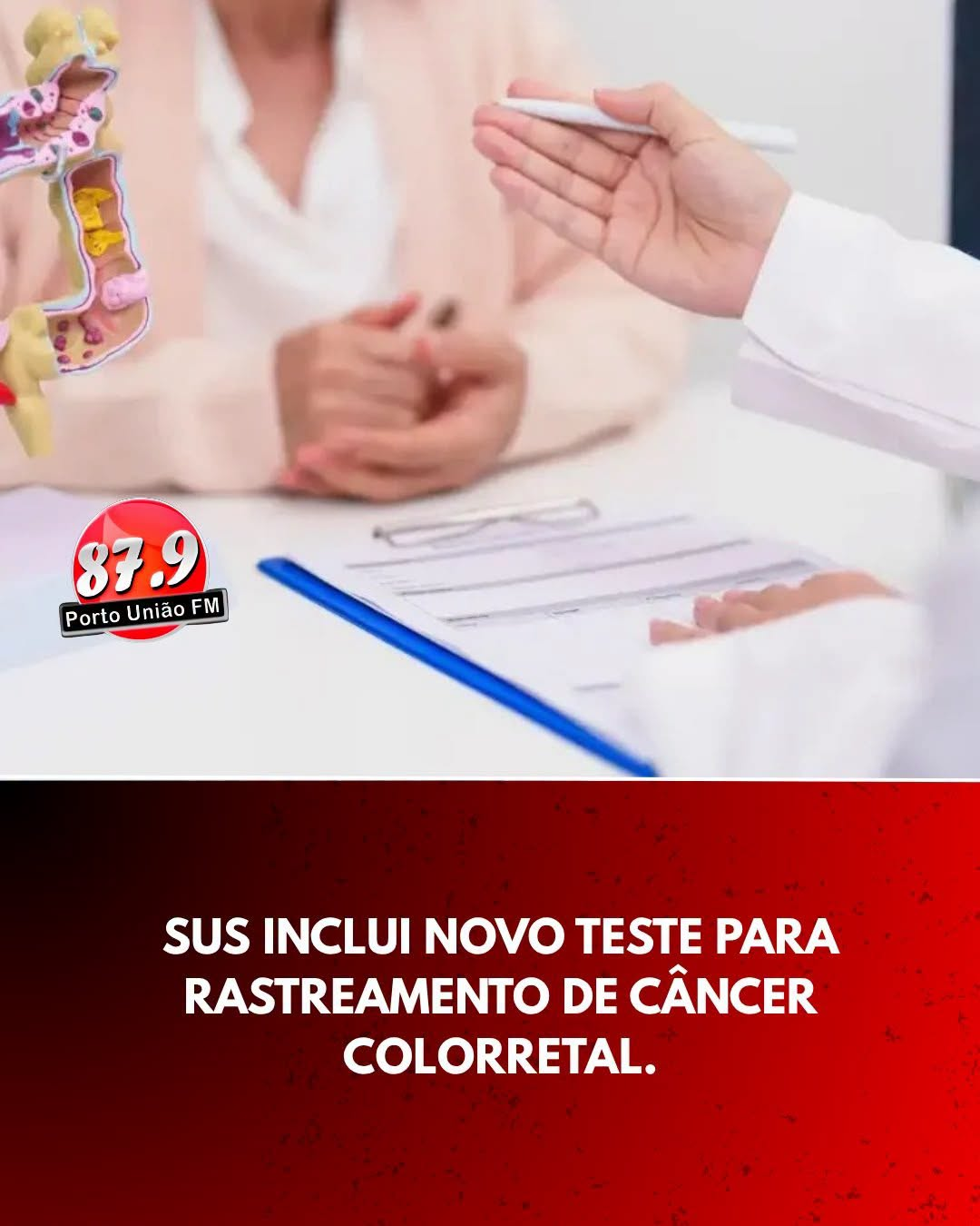 SUS passa a oferecer novo teste para rastreamento do câncer colorretal
